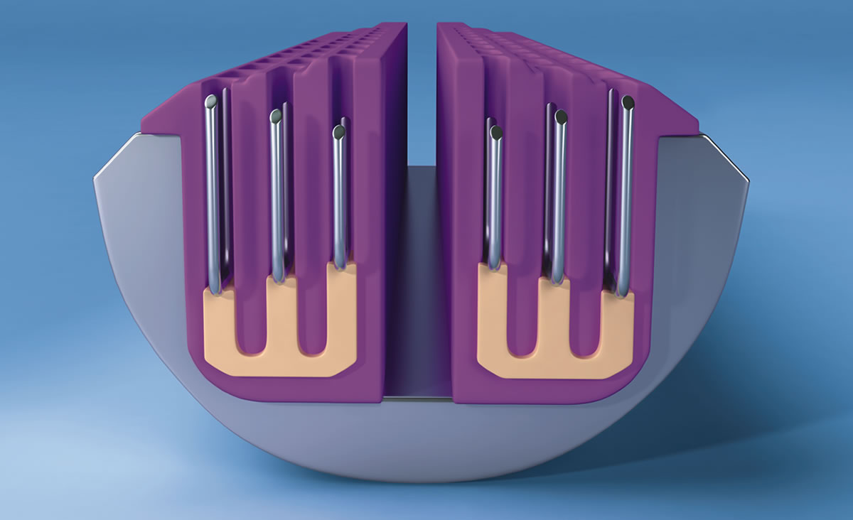 Intelligent Compression